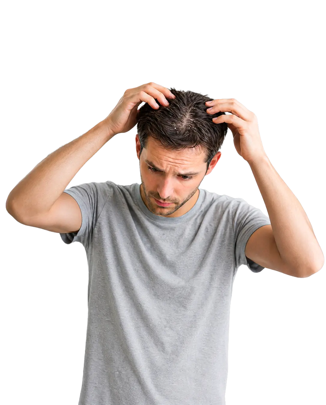 Ayurvedic Dandruff & Scalp Health Care